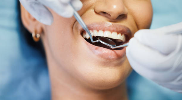 Best Emergency Wisdom Teeth Removal in Mount Hermon, VA
