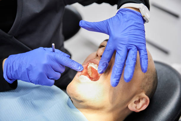 Best Emergency Broken Tooth Repair in Mount Hermon, VA